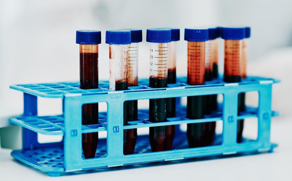 Medicina Regenerativa