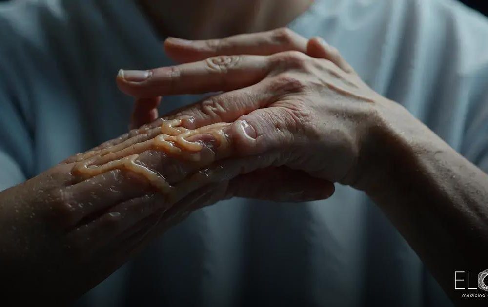 Como é uma crise de neuropátia? sintomas, sensações e o que esperar Como é uma crise de neuropátia? sintomas, sensações e o que esperar